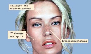 skin damage